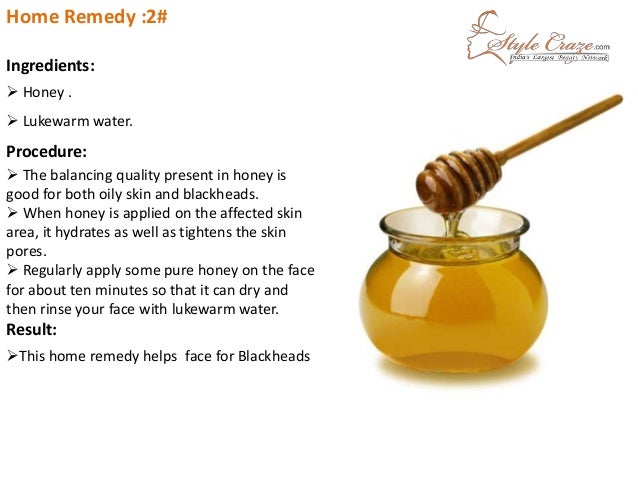 Home Remedies Honey For Acne Home Remedies Honey For Acne
