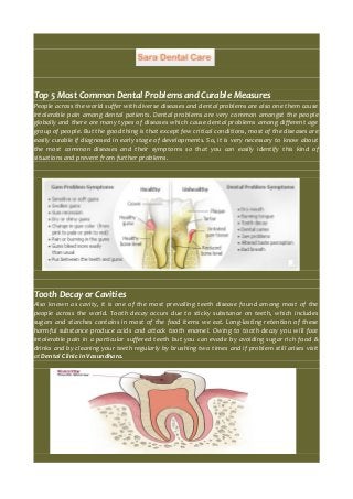 Top 5 Most Common Dental Problems and Curable Measures

People across the world suffer with diverse diseases and dental problems are also one them cause
intolerable pain among dental patients. Dental problems are very common amongst the people
globally and there are many types of diseases which cause dental problems among different age
group of people. But the good thing is that except few critical conditions, most of the diseases are
easily curable if diagnosed in early stage of developments. So, it is very necessary to know about
the most common diseases and their symptoms so that you can easily identify this kind of
situations and prevent from further problems.

Tooth Decay or Cavities
Also known as cavity, it is one of the most prevailing teeth disease found among most of the
people across the world. Tooth decay occurs due to sticky substance on teeth, which includes
sugars and starches contains in most of the food items we eat. Long-lasting retention of these
harmful substance produce acids and attack tooth enamel. Owing to tooth decay you will face
intolerable pain in a particular suffered teeth but you can evade by avoiding sugar rich food &
drinks and by cleaning your teeth regularly by brushing two times and if problem still arises visit
at Dental Clinic in Vasundhara.

 