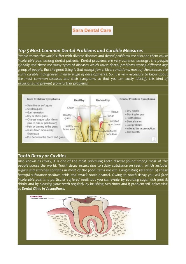 Top 5 most common dental problems and curable measures