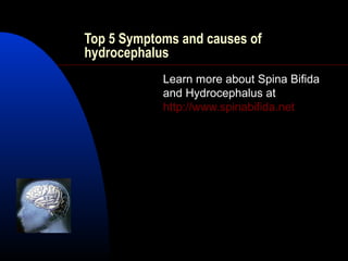Top 5 Symptoms and causes of
hydrocephalus
Learn more about Spina Bifida
and Hydrocephalus at
http://www.spinabifida.net
 