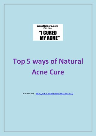 Top 5 ways of Natural
Acne Cure
Published by : http://www.treatmentforadultacne.net/
 