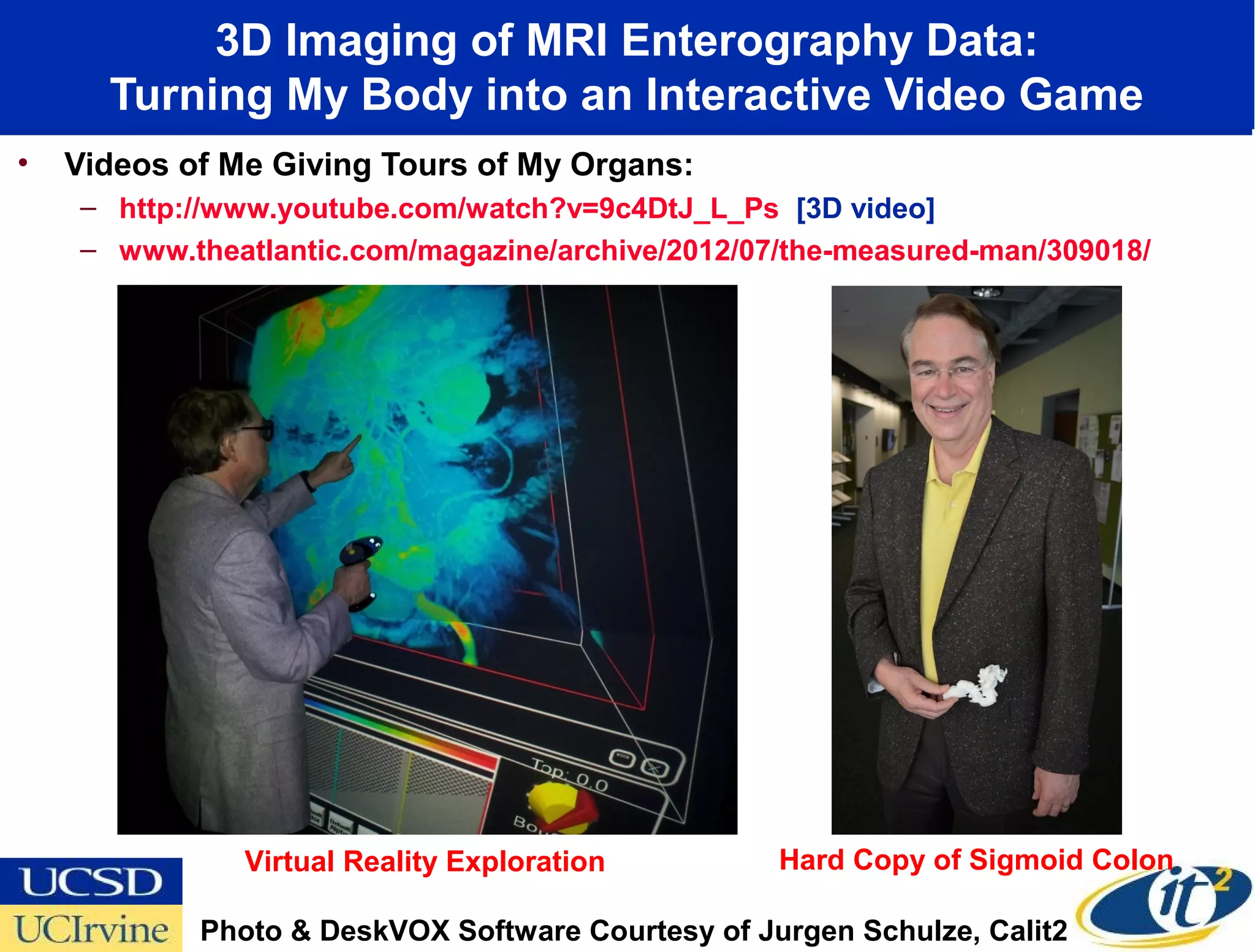3D Imaging of MRI Enterography Data:
      Turning My Body into an Interactive Video Game
•   Videos of Me Giving Tours of My Organs:
    – http://www.youtube.com/watch?v=9c4DtJ_L_Ps [3D video]
    – www.theatlantic.com/magazine/archive/2012/07/the-measured-man/309018/




               Virtual Reality Exploration         Hard Copy of Sigmoid Colon

            Photo & DeskVOX Software Courtesy of Jurgen Schulze, Calit2
 