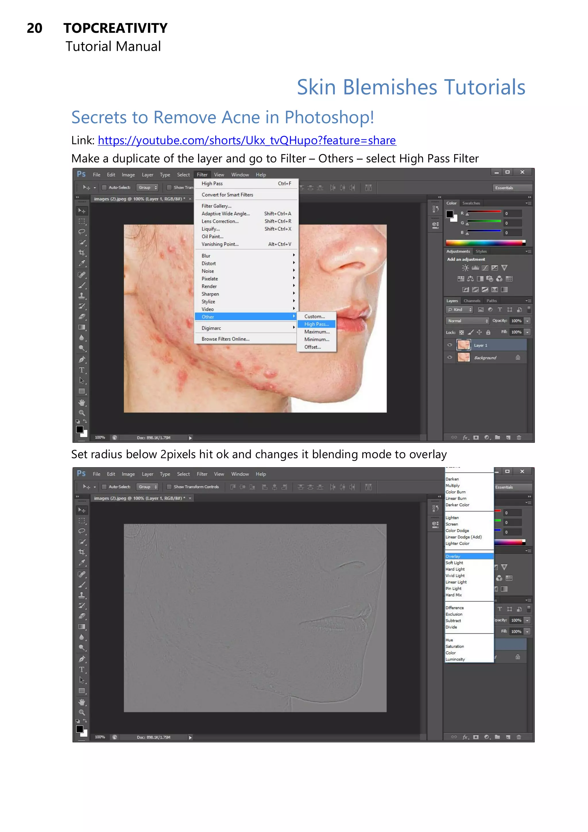 20 TOPCREATIVITY
Tutorial Manual
Skin Blemishes Tutorials
Secrets to Remove Acne in Photoshop!
Link: https://youtube.com/shorts/Ukx_tvQHupo?feature=share
Make a duplicate of the layer and go to Filter – Others – select High Pass Filter
Set radius below 2pixels hit ok and changes it blending mode to overlay
 