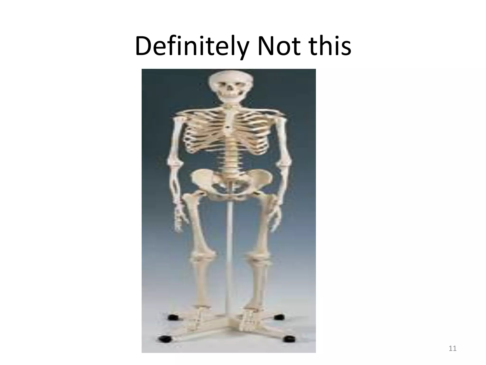 Definitely Not this 
11 
 