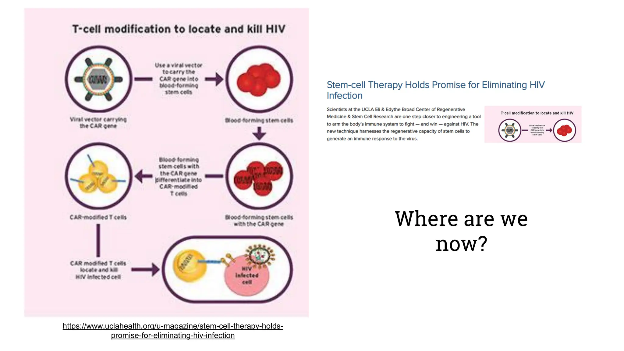 Where are we
now?
https://www.uclahealth.org/u-magazine/stem-cell-therapy-holds-
promise-for-eliminating-hiv-infection
 