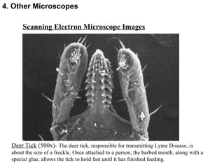 Scanning Electron Microscope Images Deer Tick  (500x)-  The deer tick, responsible for transmitting Lyme Disease, is about the size of a freckle. Once attached to a person, the barbed mouth, along with a special glue, allows the tick to hold fast until it has finished feeding.  4. Other Microscopes 