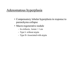Adenomatous hyperplasia
• Compensatory lobular hyperplasia in response to
parenchyma collapse
• Macro-regenerative nodule
– In cirrhosis, lesion > 1 cm
– Type I- without atypia
– Type II- Associated with atypia
 