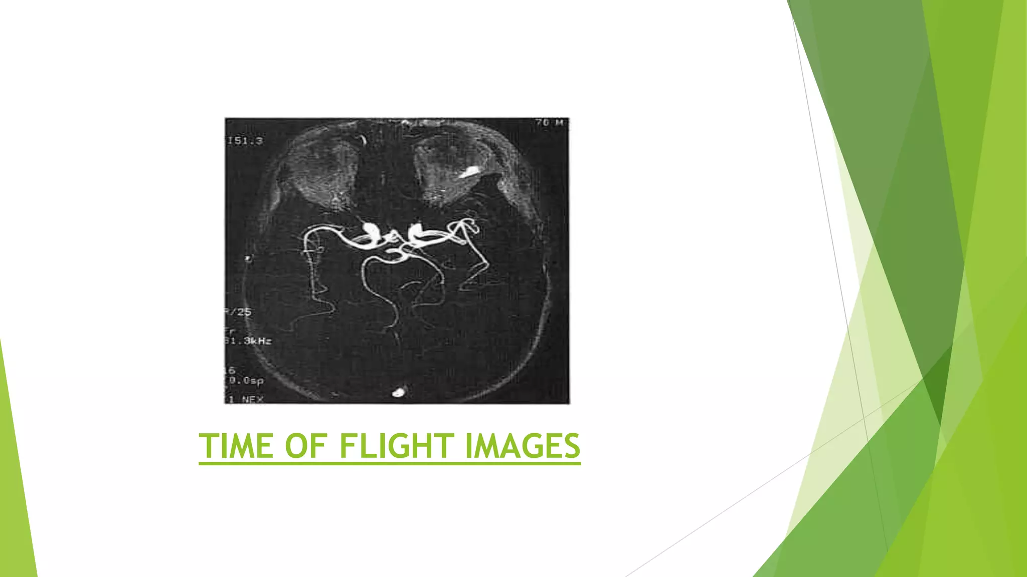 TIME OF FLIGHT IMAGES
 