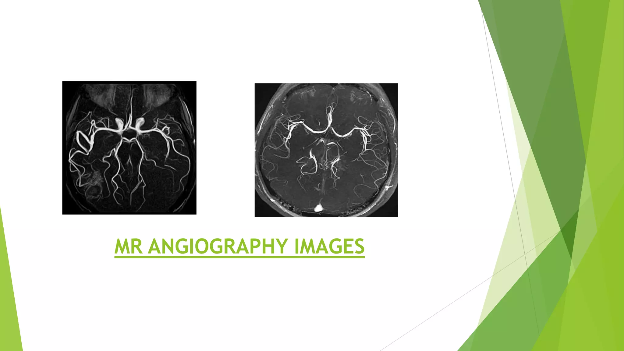 MR ANGIOGRAPHY IMAGES
 