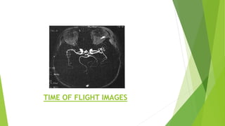 TIME OF FLIGHT IMAGES
 