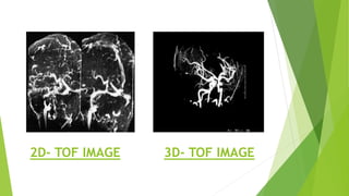 2D- TOF IMAGE 3D- TOF IMAGE
 