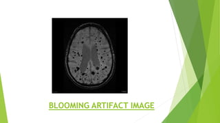 BLOOMING ARTIFACT IMAGE
 