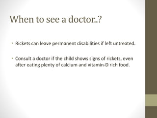 Topic- Rickets in children by Chhavi Saini | PPTX