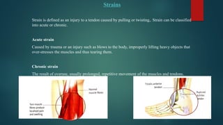 Strains
Strain is defined as an injury to a tendon caused by pulling or twisting,. Strain can be classified
into acute or chronic.
Acute strain
Caused by trauma or an injury such as blows to the body, improperly lifting heavy objects that
over-stresses the muscles and thus tearing them.
Chronic strain
The result of overuse, usually prolonged, repetitive movement of the muscles and tendons.
 