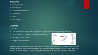 Recognition
 Local joint pain
 Swollen joint
 Joint warmth and redness
 Tenderness
 Fever
 Sick feeling
Treatment
 RICE
 Anti-inflammatory drugs such as ibuprofen or naproxen, to reduce pain and inflammation.
 Avoid smoking as it delays wound and tissue healing.
 Do not poke at the injury
 Range-of-motion exercise
Bursitis is likely to improve in a few days or weeks if proper rest and treatment is received. Note that if the
situation persists or if one has severe bursitis, seek medical attention to remove the extra fluid. Worst case
scenario, an infection known as septic bursitis will occur due to the fluids and antibiotics are needed.
 