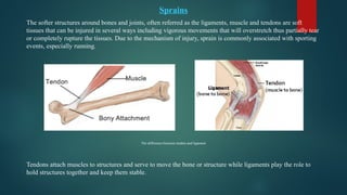 Sprains
The softer structures around bones and joints, often referred as the ligaments, muscle and tendons are soft
tissues that can be injured in several ways including vigorous movements that will overstretch thus partially tear
or completely rupture the tissues. Due to the mechanism of injury, sprain is commonly associated with sporting
events, especially running.
The difference between tendon and ligament
Tendons attach muscles to structures and serve to move the bone or structure while ligaments play the role to
hold structures together and keep them stable.
 