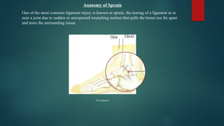 Anatomy of Sprain
One of the most common ligament injury is known as sprain, the tearing of a ligament at or
near a joint due to sudden or unexpected wrenching motion that pulls the bones too far apart
and tears the surrounding tissue.
Tore ligament
 