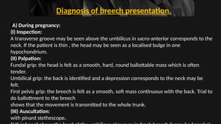 Breech presentation of the fetus……………….. | PPTX