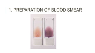 1. PREPARATION OF BLOOD SMEAR
 