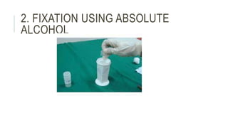 2. FIXATION USING ABSOLUTE
ALCOHOL
 