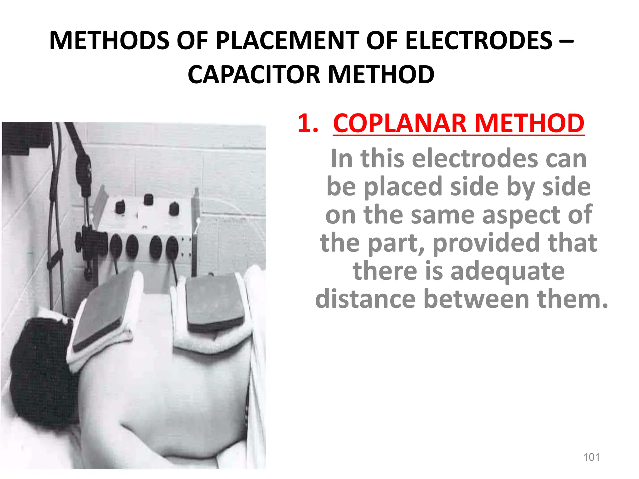 METHODS OF PLACEMENT OF ELECTRODES –
CAPACITOR METHOD
1. COPLANAR METHOD
In this electrodes can
be placed side by side
on the same aspect of
the part, provided that
there is adequate
distance between them.
101
 