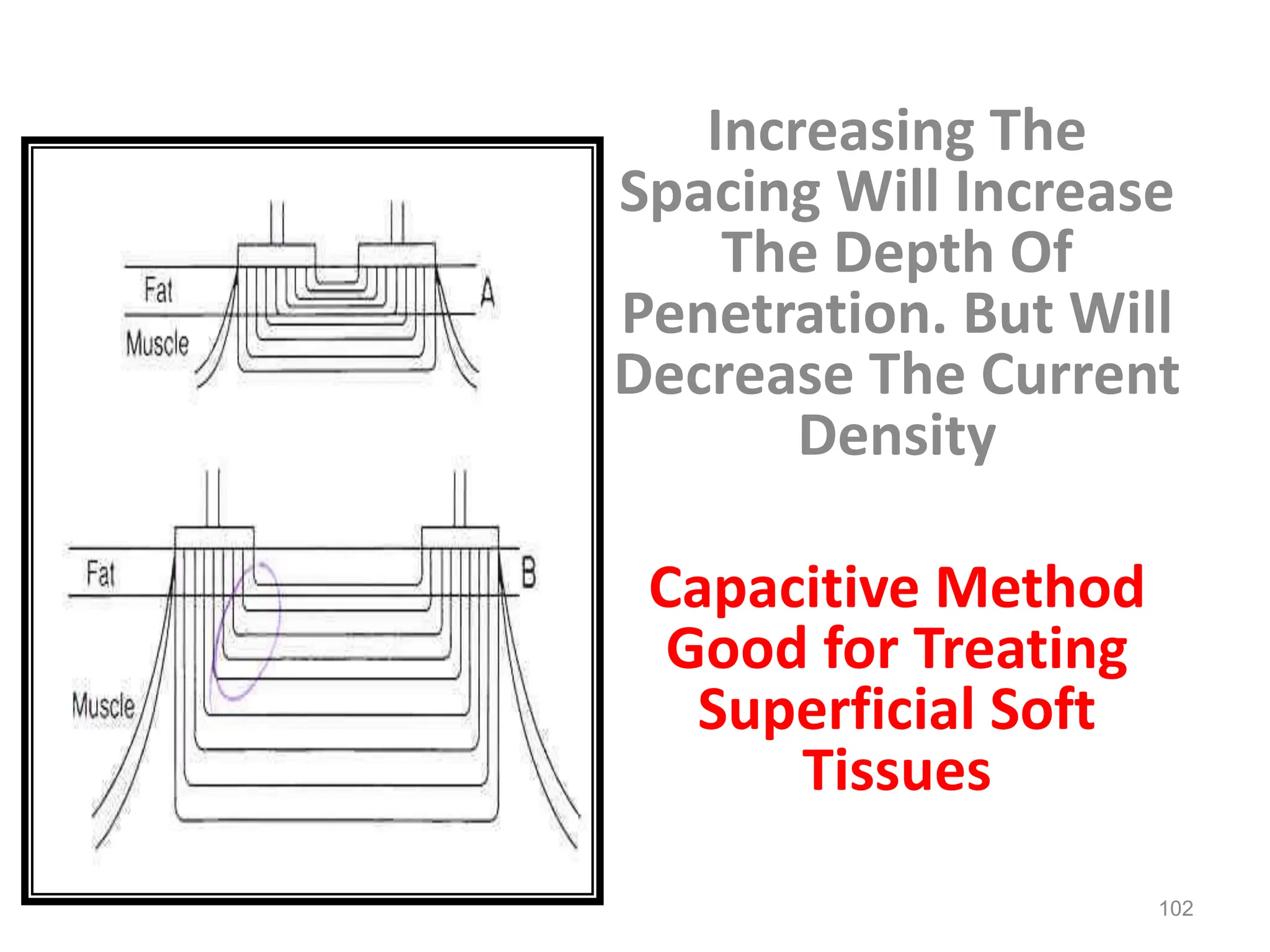 Increasing The
Spacing Will Increase
The Depth Of
Penetration. But Will
Decrease The Current
Density
Capacitive Method
Good for Treating
Superficial Soft
Tissues
102
 