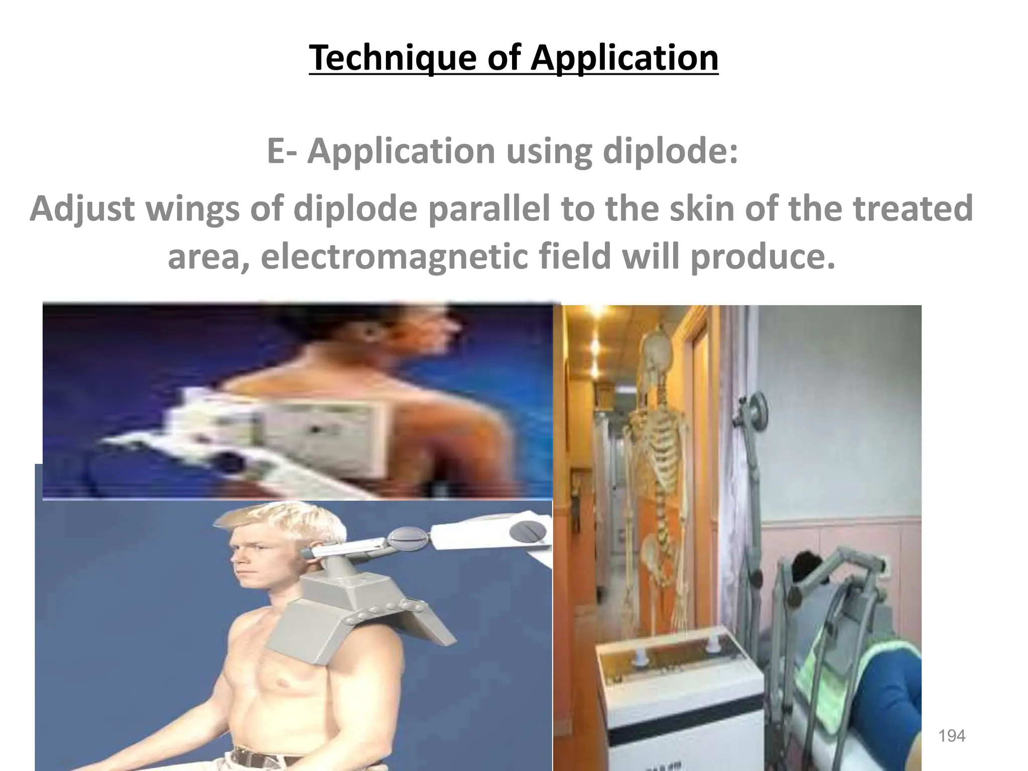 Technique of Application
E- Application using diplode:
Adjust wings of diplode parallel to the skin of the treated
area, electromagnetic field will produce.
194
 