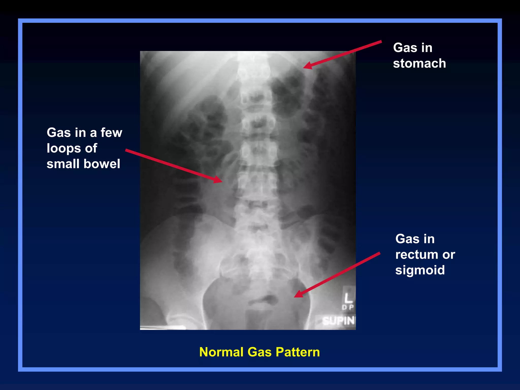 Abdominal cavity organs radiological examination | PPT