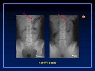 Abdominal cavity organs radiological examination | PPT