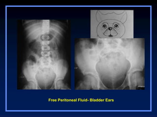 Abdominal cavity organs radiological examination | PPT