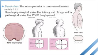 Topic 14 - Inspection of the chest [Autosaved].pptx