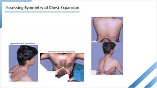 Topic 14 - Inspection of the chest [Autosaved].pptx