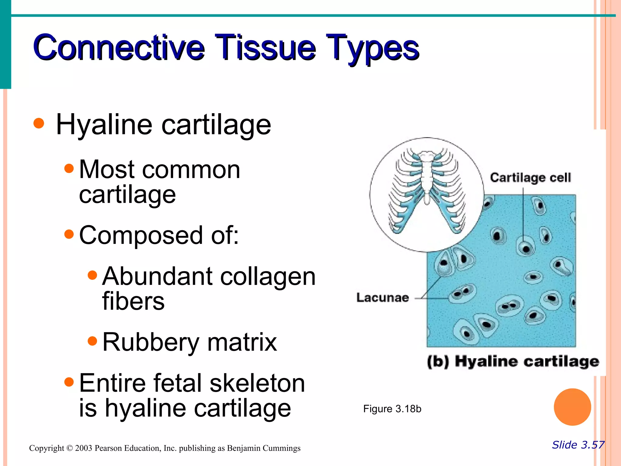 Connective Tissue Types

• Hyaline cartilage
        • Most common
          cartilage
        • Composed of:
               • Abundant collagen
                 fibers
               • Rubbery matrix
        • Entire fetal skeleton
          is hyaline cartilage                                             Figure 3.18b


Copyright © 2003 Pearson Education, Inc. publishing as Benjamin Cummings                  Slide 3.57
 