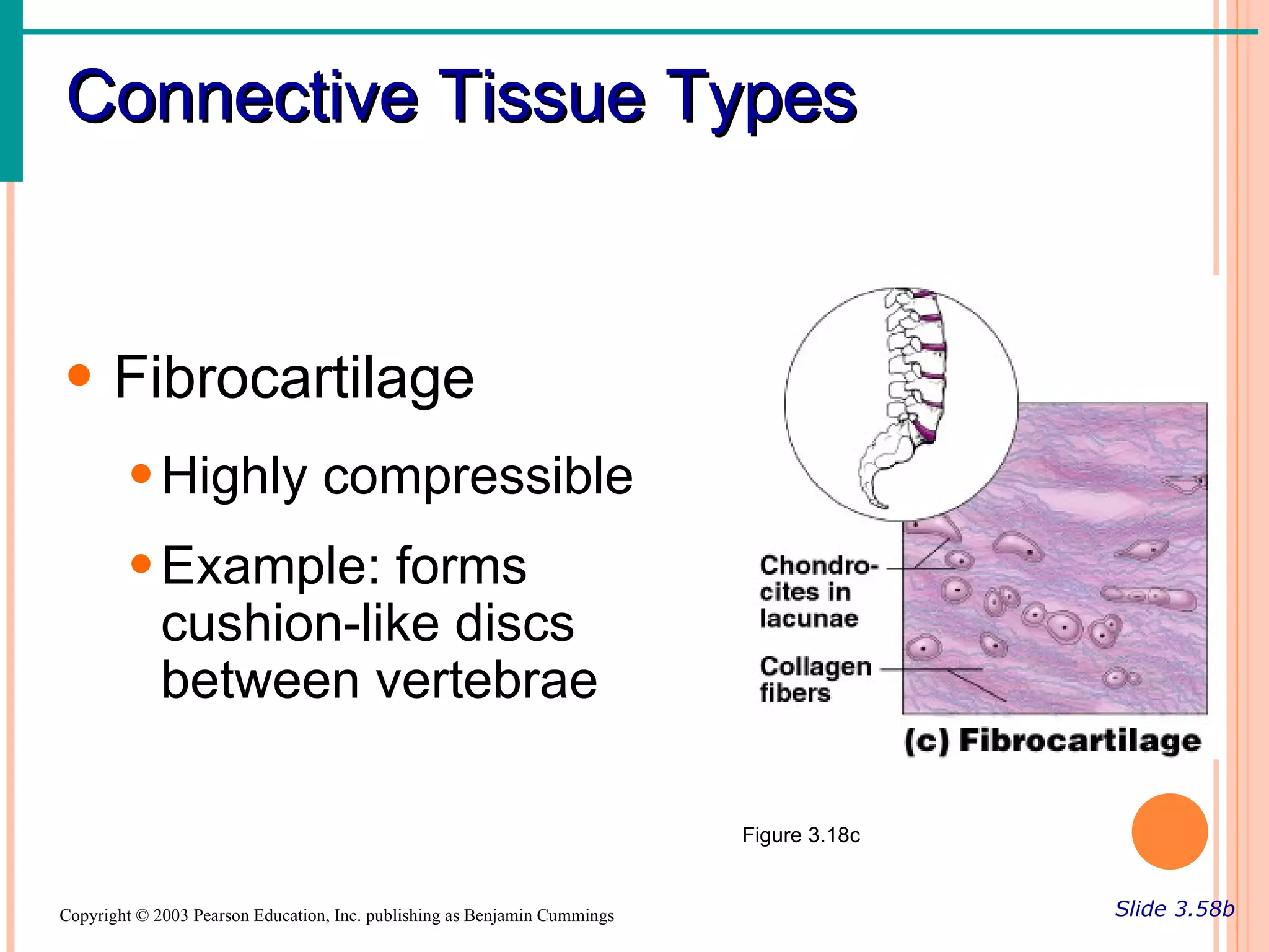 Connective Tissue Types


• Fibrocartilage
        • Highly compressible
        • Example: forms
          cushion-like discs
          between vertebrae

                                                                           Figure 3.18c


Copyright © 2003 Pearson Education, Inc. publishing as Benjamin Cummings                  Slide 3.58b
 