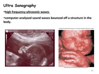 Ultra Sonography
•high frequency ultrasonic waves
•computer-analyzed sound waves bounced off a structure in the
body.
22
 