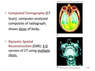 • Computed Tomography (CT
Scan): computer-analyzed
composite of radiograph;
shows slices of body.
• Dynamic Spatial
Reconstruction (DSR): 3-D
version of CT using multiple
slices.
1-24
 