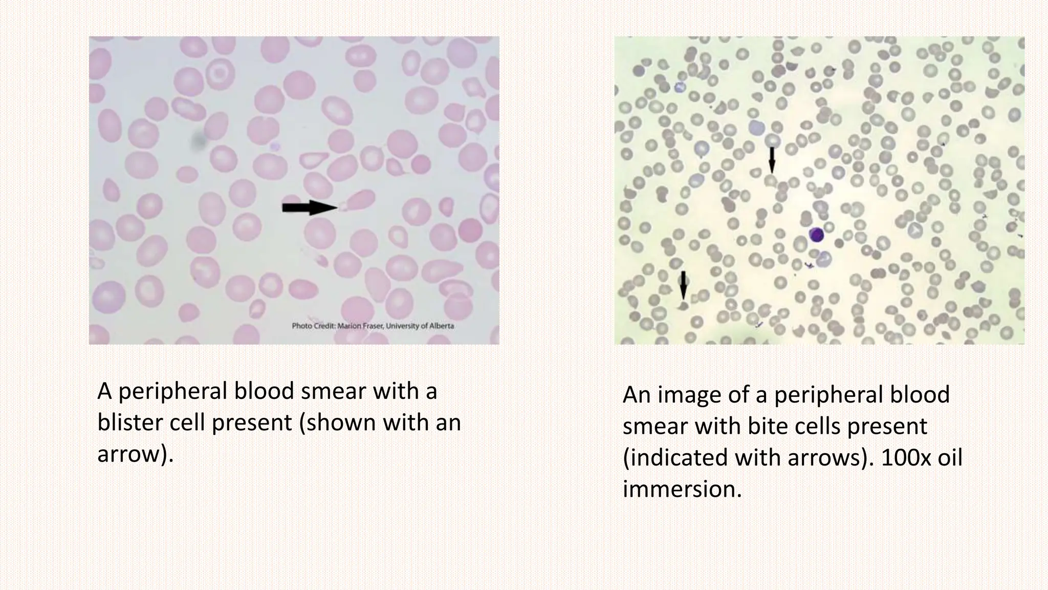 TOPIC 1 HEMATOLOGY RED CELL MORPHOLOGY STUDY.pptx