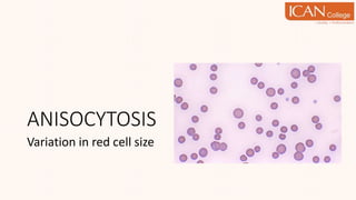 ANISOCYTOSIS
Variation in red cell size
 