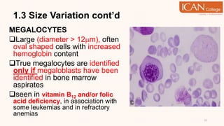 1.3 Size Variation cont’d
MEGALOCYTES
Large (diameter > 12m), often
oval shaped cells with increased
hemoglobin content
True megalocytes are identified
only if megaloblasts have been
identified in bone marrow
aspirates
seen in vitamin B12 and/or folic
acid deficiency, in association with
some leukemias and in refractory
anemias
15
 