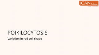 POIKILOCYTOSIS
Variation in red cell shape
 