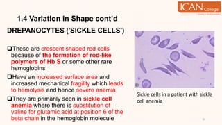1.4 Variation in Shape cont’d
DREPANOCYTES ('SICKLE CELLS')
These are crescent shaped red cells
because of the formation of rod-like
polymers of Hb S or some other rare
hemoglobins
Have an increased surface area and
increased mechanical fragility which leads
to hemolysis and hence severe anemia
They are primarily seen in sickle cell
anemia where there is substitution of
valine for glutamic acid at position 6 of the
beta chain in the hemoglobin molecule 20
Sickle cells in a patient with sickle
cell anemia
 