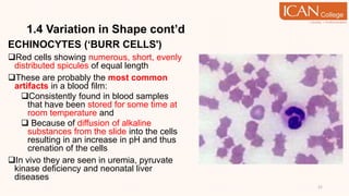 1.4 Variation in Shape cont’d
ECHINOCYTES (‘BURR CELLS')
Red cells showing numerous, short, evenly
distributed spicules of equal length
These are probably the most common
artifacts in a blood film:
Consistently found in blood samples
that have been stored for some time at
room temperature and
 Because of diffusion of alkaline
substances from the slide into the cells
resulting in an increase in pH and thus
crenation of the cells
In vivo they are seen in uremia, pyruvate
kinase deficiency and neonatal liver
diseases
21
 