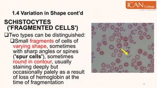 1.4 Variation in Shape cont’d
SCHISTOCYTES
('FRAGMENTED CELLS')
Two types can be distinguished:
Small fragments of cells of
varying shape, sometimes
with sharp angles or spines
('spur cells'), sometimes
round in contour, usually
staining deeply but
occasionally palely as a result
of loss of hemoglobin at the
time of fragmentation 24
 