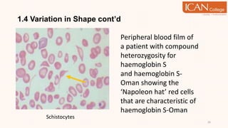 1.4 Variation in Shape cont’d
26
Schistocytes
Peripheral blood film of
a patient with compound
heterozygosity for
haemoglobin S
and haemoglobin S-
Oman showing the
‘Napoleon hat’ red cells
that are characteristic of
haemoglobin S-Oman
 