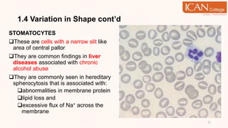 1.4 Variation in Shape cont’d
STOMATOCYTES
These are cells with a narrow slit like
area of central pallor
They are common findings in liver
diseases associated with chronic
alcohol abuse
They are commonly seen in hereditary
spherocytosis that is associated with:
abnormalities in membrane protein
lipid loss and
excessive flux of Na+ across the
membrane
31
 