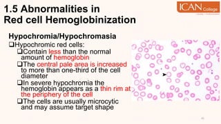 1.5 Abnormalities in
Red cell Hemoglobinization
Hypochromia/Hypochromasia
Hypochromic red cells:
Contain less than the normal
amount of hemoglobin
The central pale area is increased
to more than one-third of the cell
diameter
In severe hypochromia the
hemoglobin appears as a thin rim at
the periphery of the cell
The cells are usually microcytic
and may assume target shape
41
 