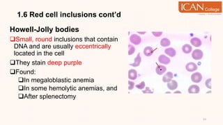 1.6 Red cell inclusions cont’d
Howell-Jolly bodies
Small, round inclusions that contain
DNA and are usually eccentrically
located in the cell
They stain deep purple
Found:
In megaloblastic anemia
In some hemolytic anemias, and
After splenectomy
53
 