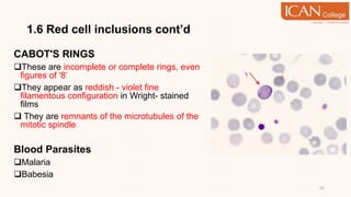 1.6 Red cell inclusions cont’d
CABOT'S RINGS
These are incomplete or complete rings, even
figures of '8’
They appear as reddish - violet fine
filamentous configuration in Wright- stained
films
 They are remnants of the microtubules of the
mitotic spindle
Blood Parasites
Malaria
Babesia
55
 