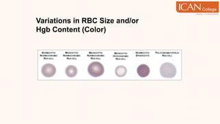 Variations in RBC Size and/or
Hgb Content (Color)
 