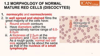 1.2 MORPHOLOGY OF NORMAL
MATURE RED CELLS (DISCOCYTES)
1. normocytic and normochromic
2. In well spread and stained films the
great majority of the cells have:
i. Round smooth contours
ii. Have diameters within the
comparatively narrow range of 6.0-
8.0m
iii. A thickness of 2.5m at the
periphery and 1.0m in the center
As a rough guide, normal red cell
size appears to be about the same
as that of the nucleus of a small
lymphocyte
8
 
